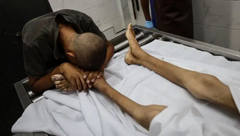 Gazze’de Açlık Faciası: Bir Çocuk Daha Hayatını Kaybetti