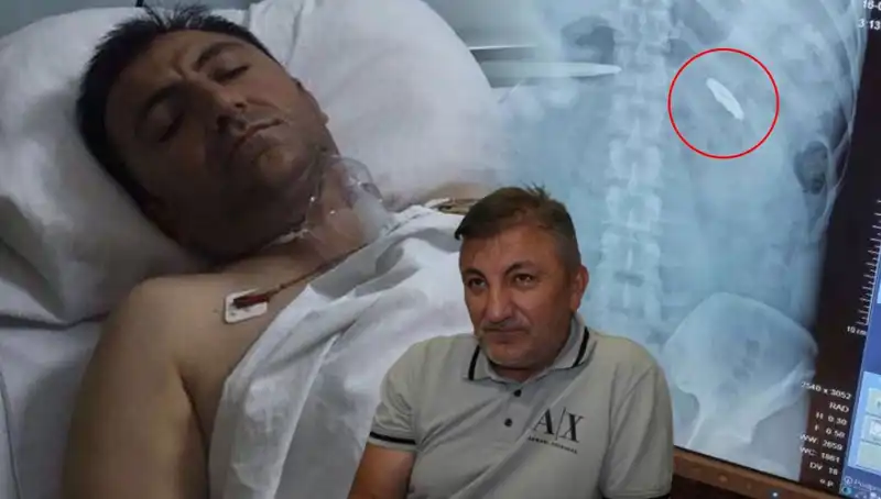 15 Temmuz'un Karanlık Yüzü: Vücudunda Kurşunla Yaşayan Kahraman
