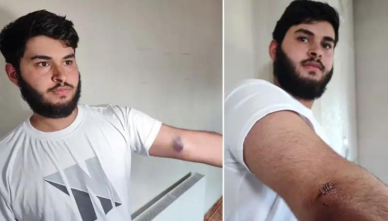 Bahçeye Kaçan Top, Mahallede Şaşkınlık Yarattı!